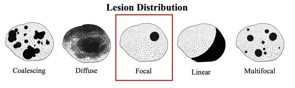 BBD Lesion Distribution