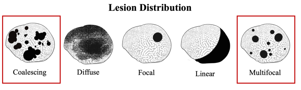 DSD Lesion Ditribution