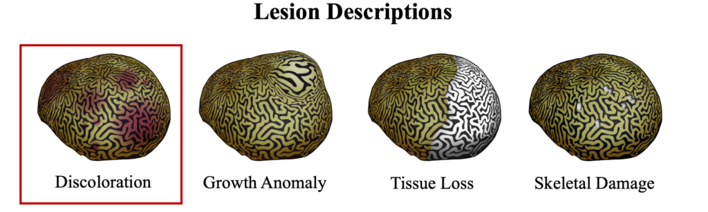 DSD Lesion Type