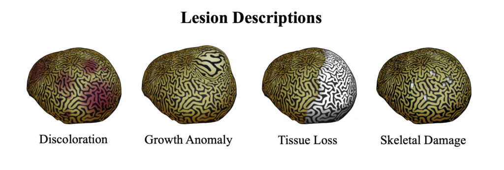 Lesion Description Diagram