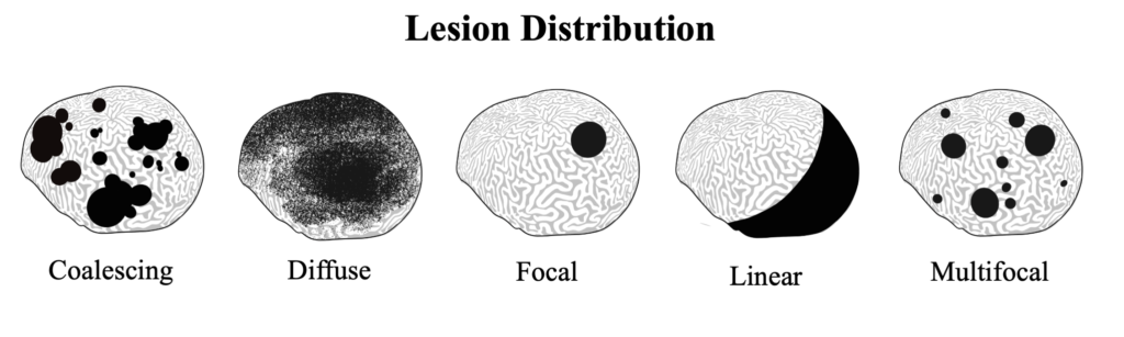 Lesion Distribution