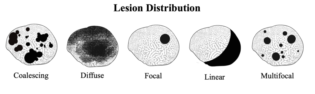 Diffuse annular lesions