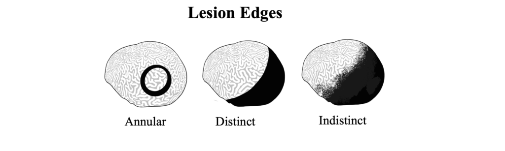 Lesion Location