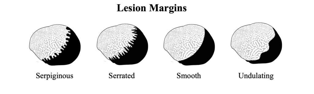 Lesion Margins