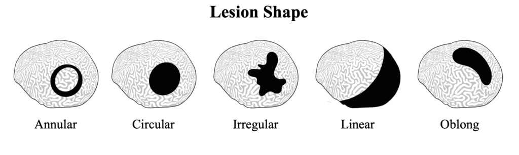 Lesion Shape