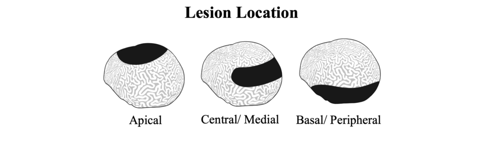 Lesion Location