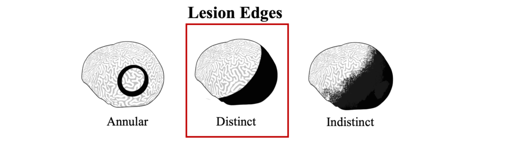 WBD Lesion Edges
