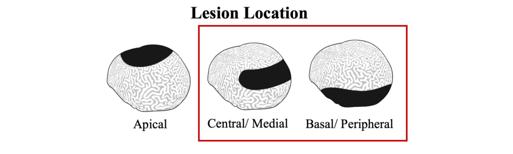 WBD Lesion Location
