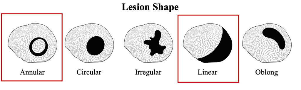 WBD Lesion Shape