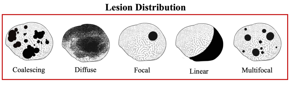 WP Lesion Distribution