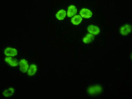Microscope image of H. circularisquarma cells labeled with a species-specific, fluorescently-tagged molecular probe designed by NOAA scientists. The probe will be applied to water samples to aid in the detection and enumeration of this HAB species by phytoplankton monitoring programs. (credit: NOAA)