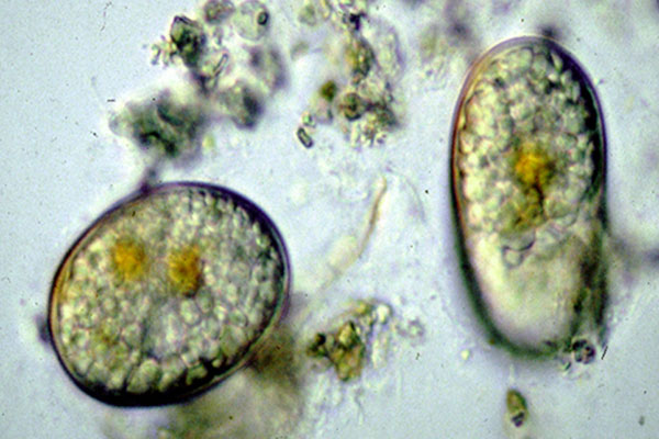 Seed-like cysts of the harmful algae Alexandrium fundyense. Credit: NOAA