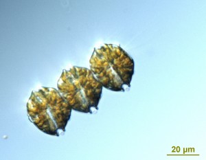 Alexandrium catenella (Credit S. Moore, NOAA NMFS)