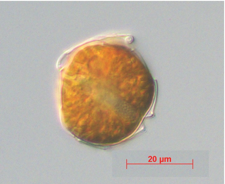Alexandrium fundyense is a dinoflagellate responsible for harmful algal blooms in the Gulf of Maine.