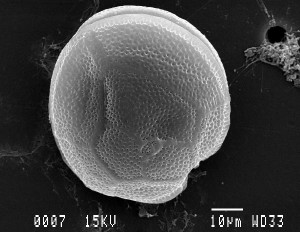 Electron microscope image of Gambierdiscus toxicus. (Credit M. Richlen, WHOI)  