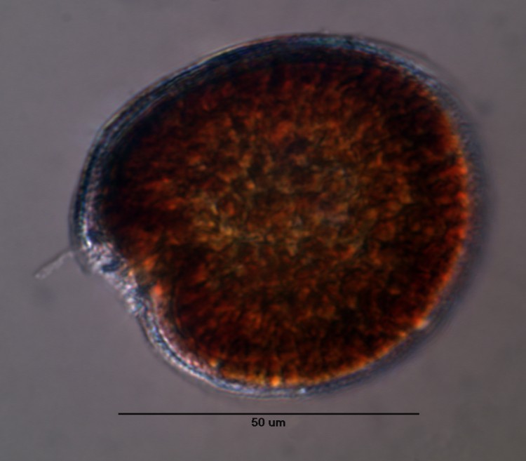 Light micrograph of Gambierdiscus carolinianus, a Caribbean dinoflagellate species associated with Ciguatera Fish Poisoning. Credit: Mark Vandersea, NOAA