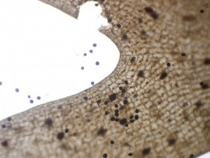 Gambierdiscus cells (left) attached to and associated with the surface of the brown seaweed host Dictyota (right). Credit Lacey Rains, Florida Gulf Coast University