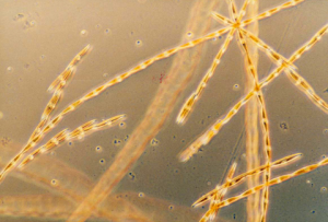 The chain forming single-celled diatom Pseudo-nitschia. Credit: NOAA Fisheries