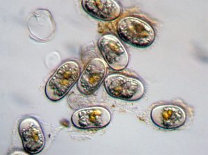 A view of Alexandrium fundyense cysts under a microscope. Credit: Woods Hole Oceanographic Institution