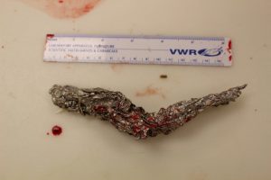 Aluminum foil measuring a little over six inches long removed from esophagus of a bottlenose dolphin stranded on Edisto Beach, South Carolina, in November.