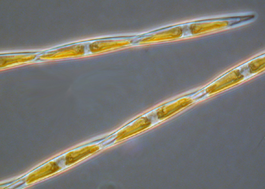 photo of the marine diatom Pseudo-nitzschia.