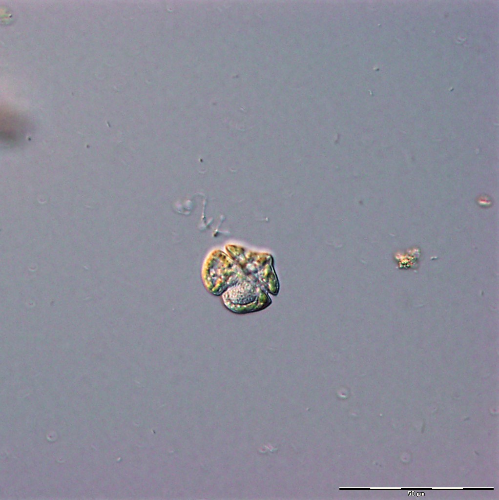 Microscopic view of phytoplankton, Karenia brevis