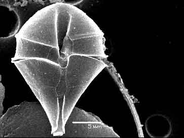 black and white scanning electron microscope image of Scrippsiella Spp
